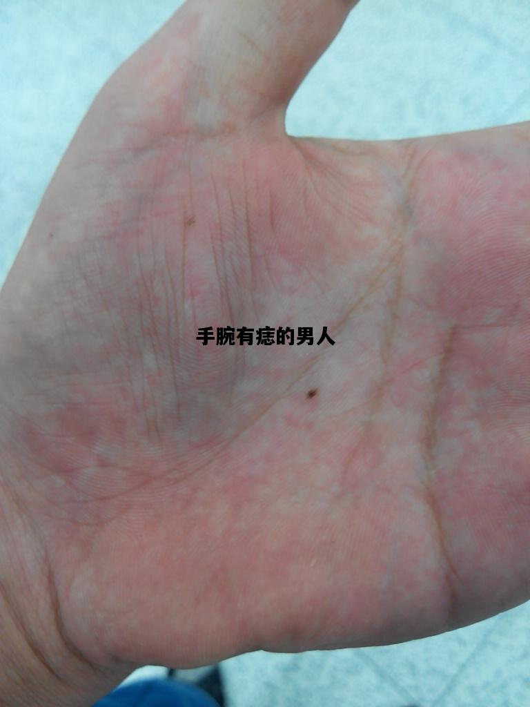 手腕有痣的男人，左手手腕有痣的男人