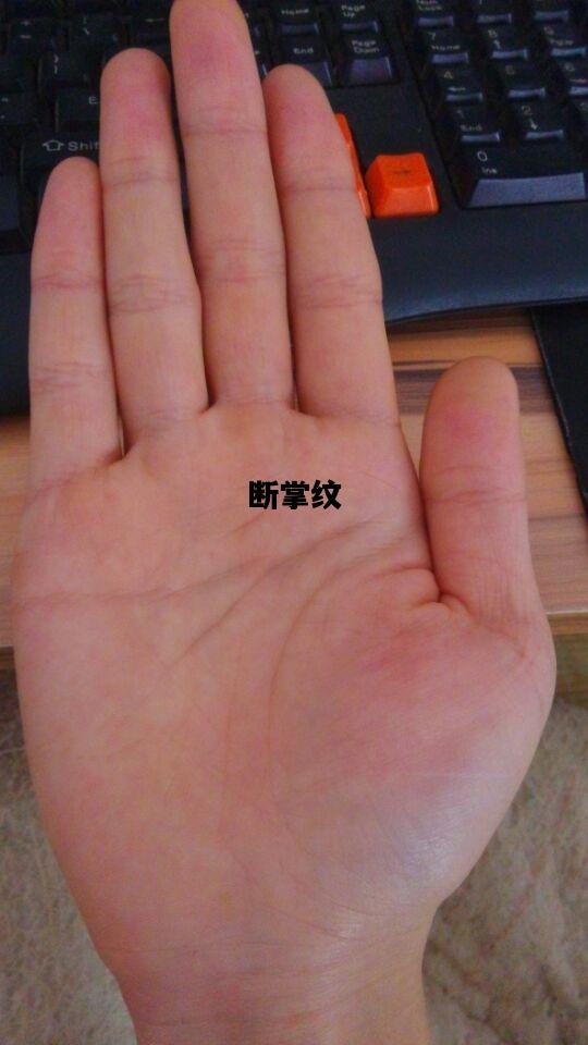 断掌纹，断掌纹的男人命运怎么样