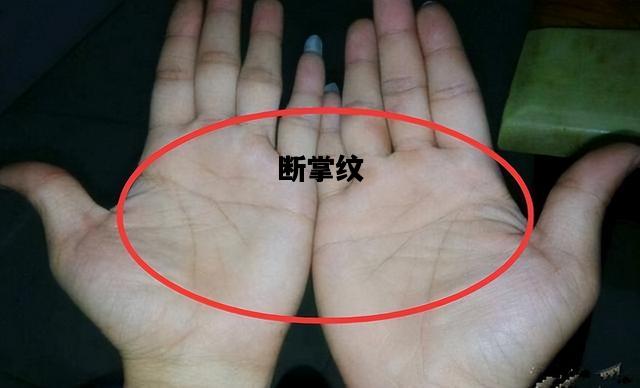 断掌纹，断掌纹的男人命运怎么样