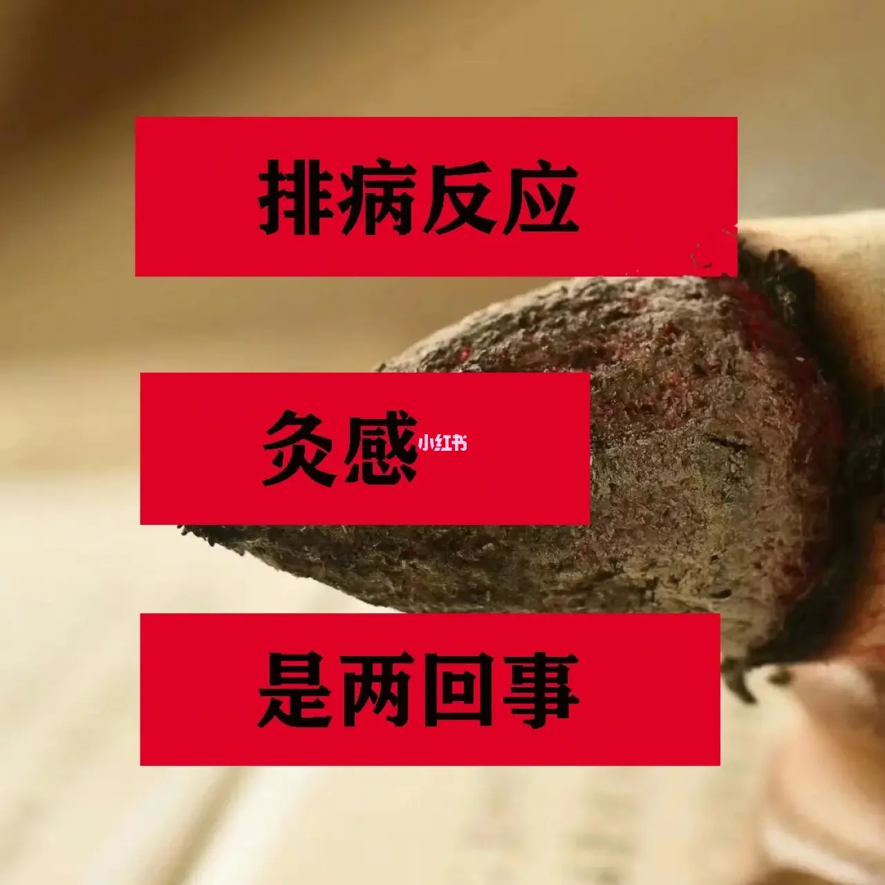 灸感，灸感反应和排病反应