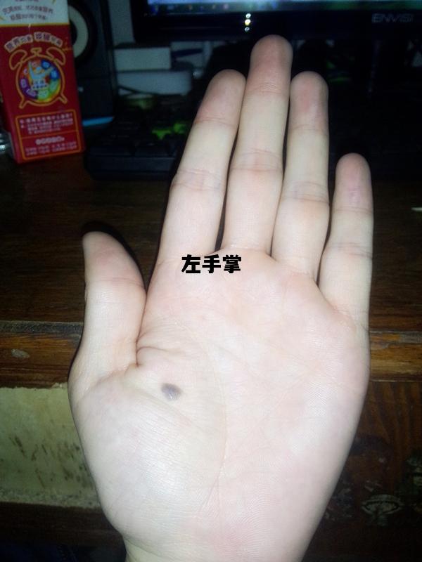 左手掌，左手掌心发麻