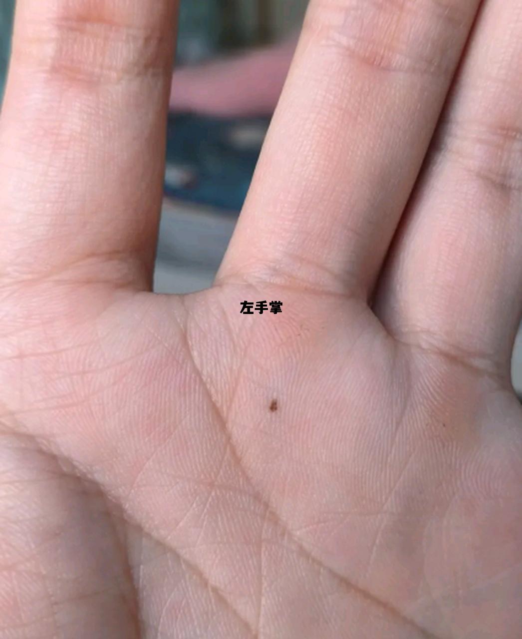 左手掌，左手掌心发麻