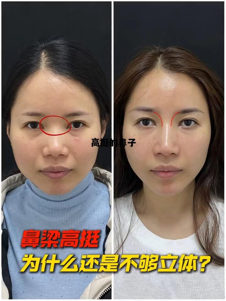 高挺的鼻子，高挺的鼻子像什么比喻句