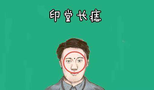 人背痣穷一生，人背痣穷一生石崇巨富