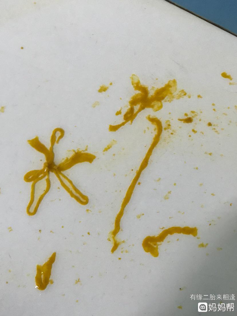 大便凹槽形状图片，大便有凹槽一定是长东西了吗