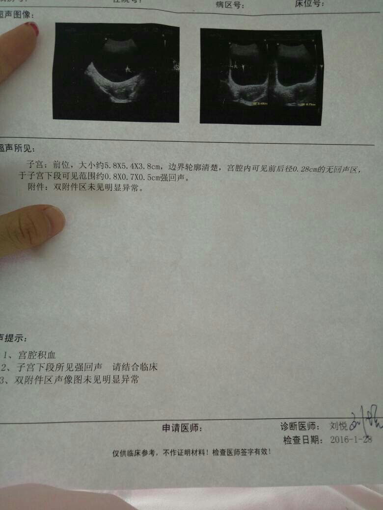 宫腔积血自然排出图片，宫腔有积血是什么原因造成的