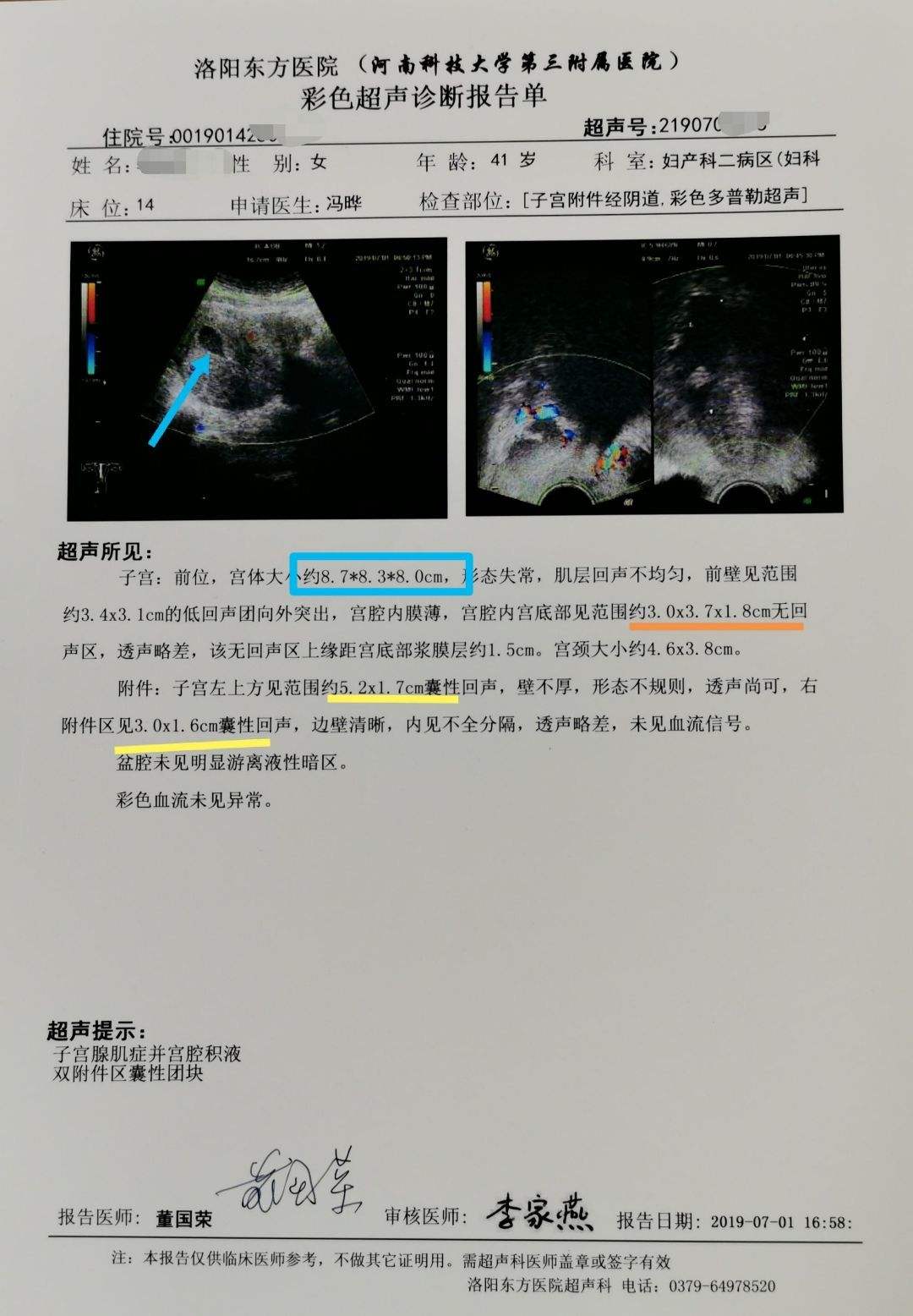 宫腔积血自然排出图片，宫腔有积血是什么原因造成的