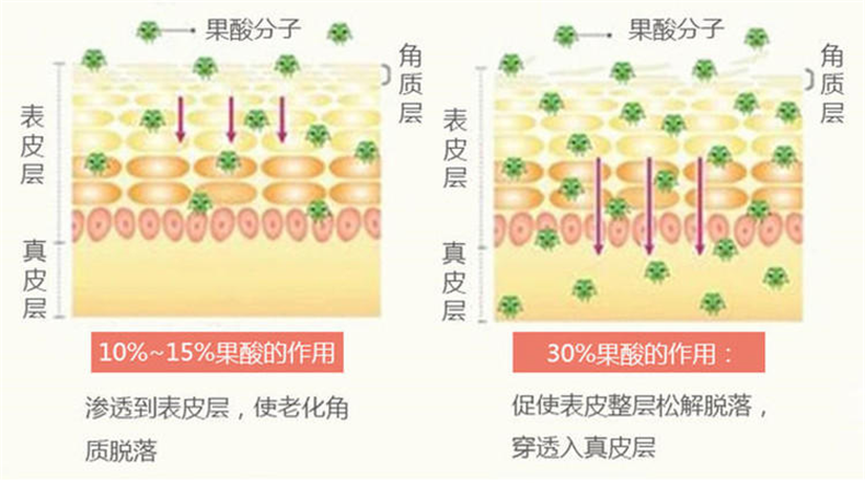 皮肤刷酸，皮肤刷酸的作用
