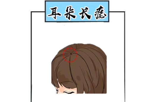 头上有痣，头上有痣代表什么 男人