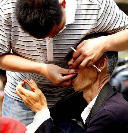 拔牙绳子的绑法图，拔牙绳子的绑法图视频