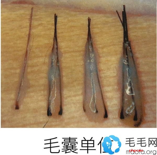 毛囊图片，正常头发毛囊图片