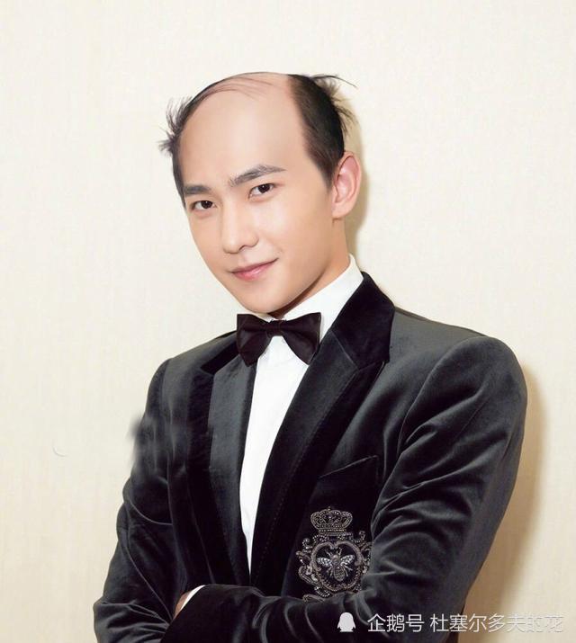 秃顶图片，秃顶图片男士