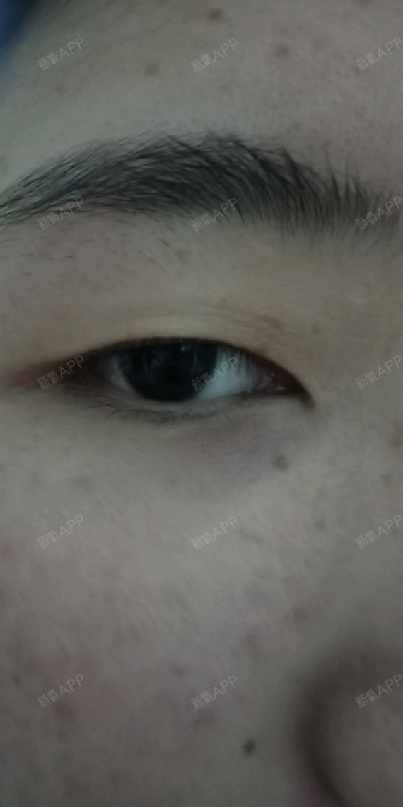 在线测眼型，测眼型在线测试