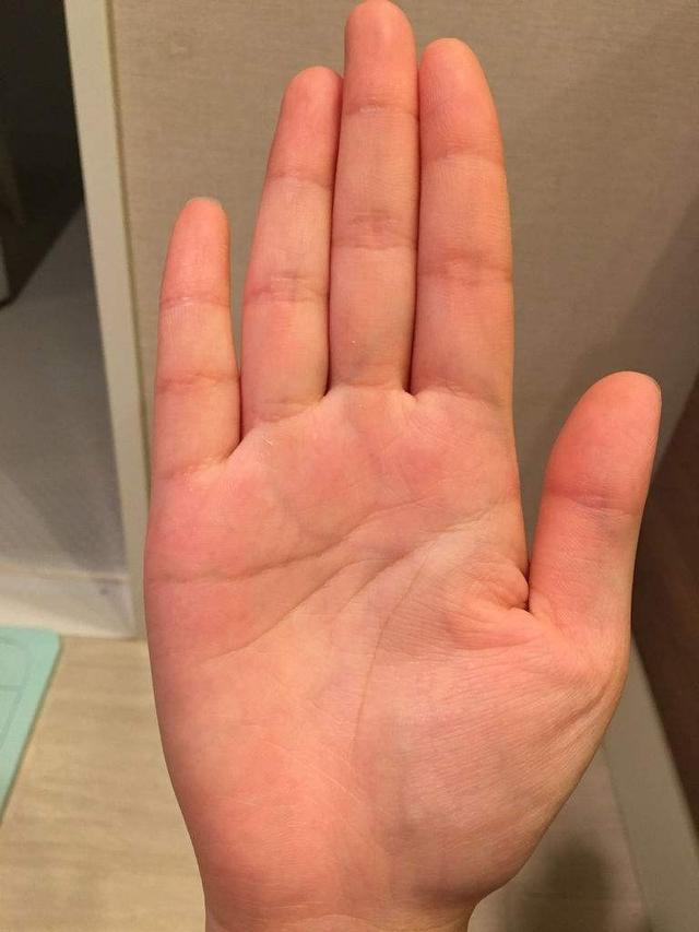 手纹断掌，手纹断掌线图解大全